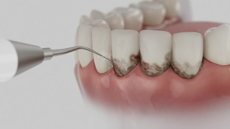 Reliable Dental Implants contractor in Patchogue, NY by Smile Center Dentistry